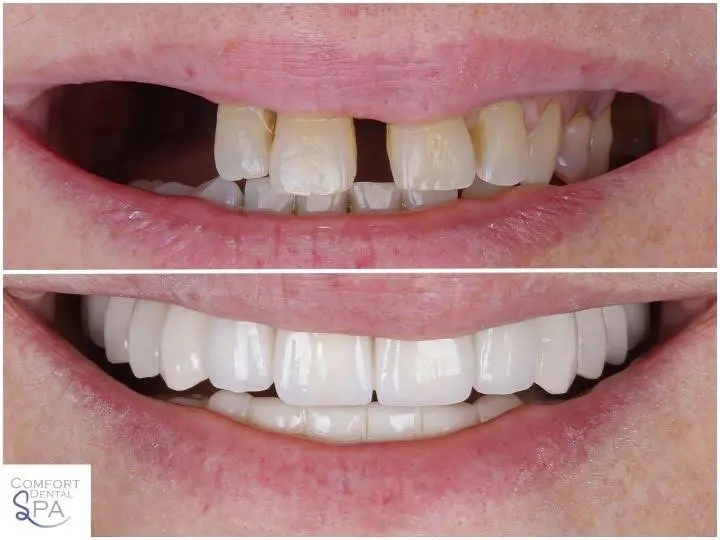 Comfort Dental Spa