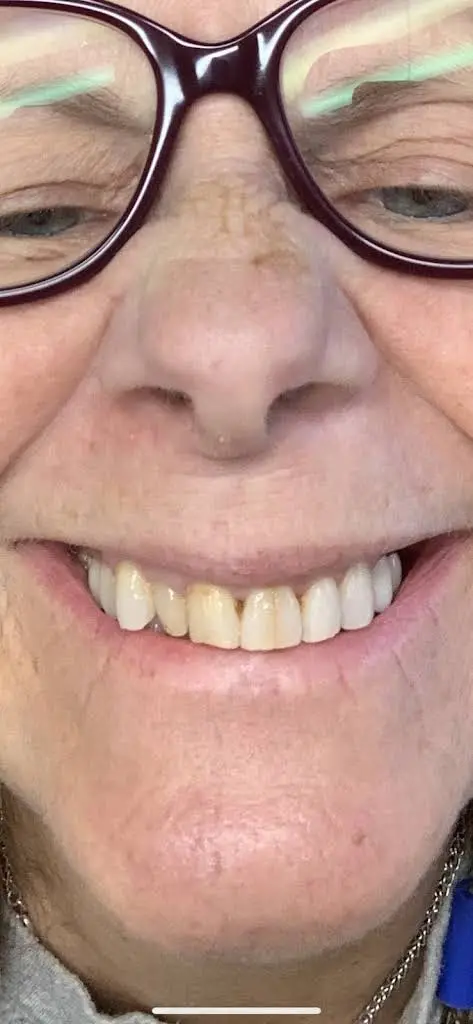 Redwood Dental Warren