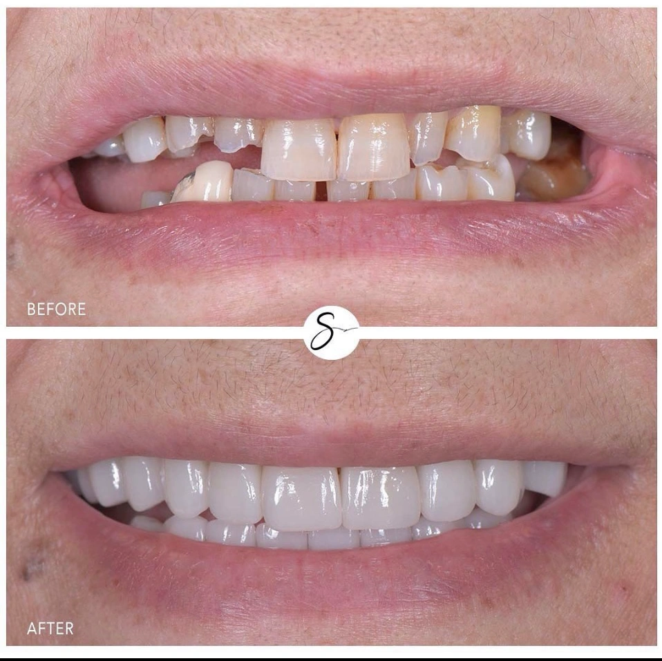 Sbenati Dentistry