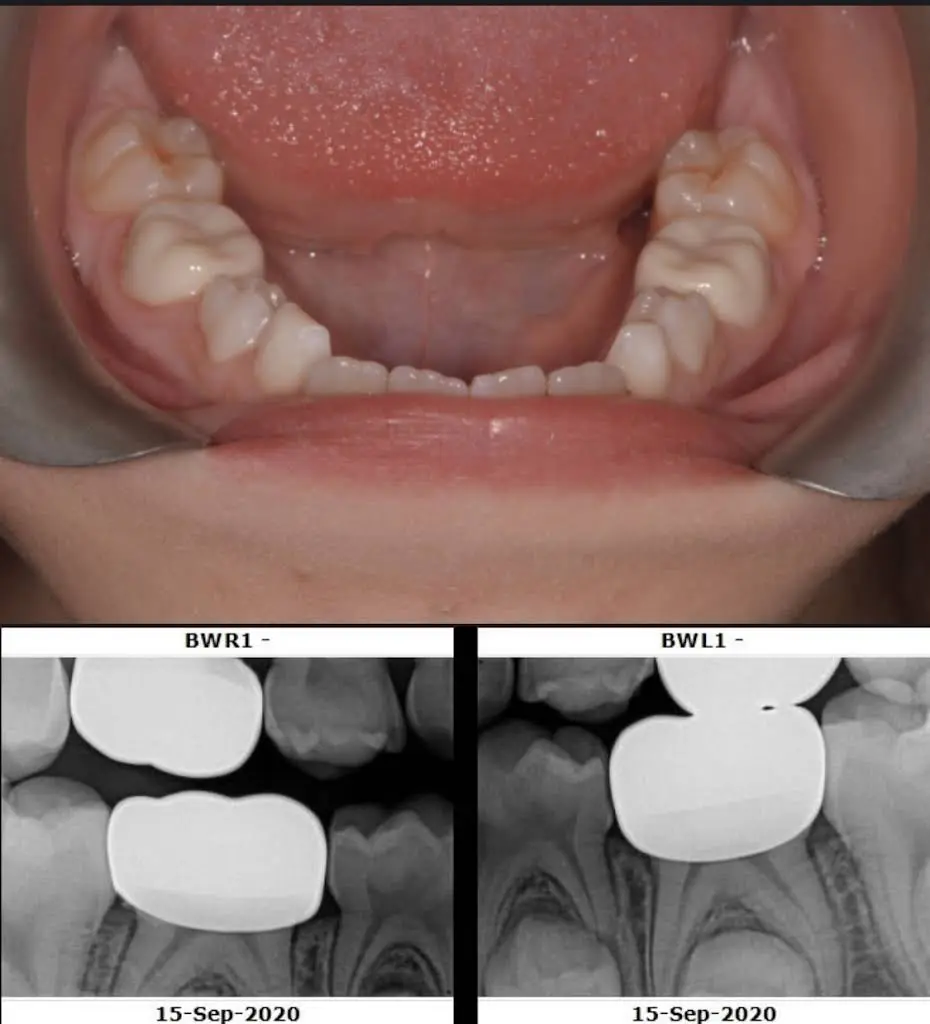 Pediatric Oral Health & Dentistry