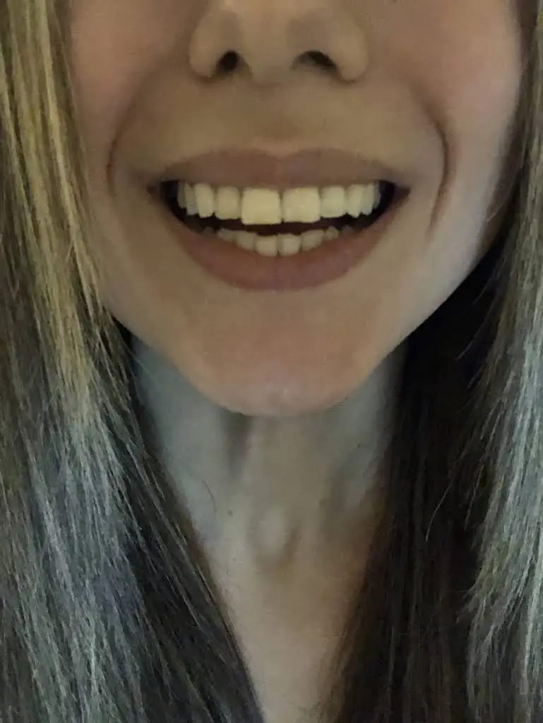 Great Expressions Dental Centers