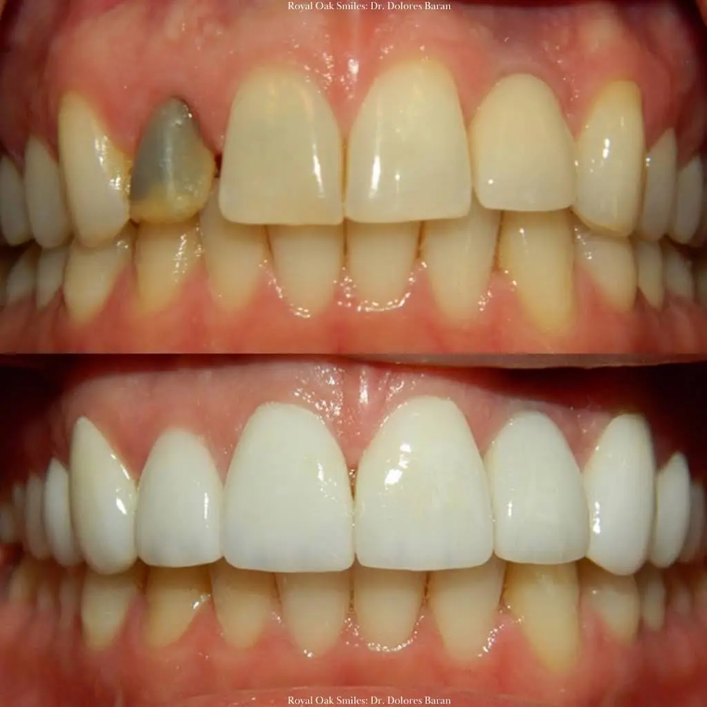 Royal Oak Smiles: Dr. Dolores Baran DDS