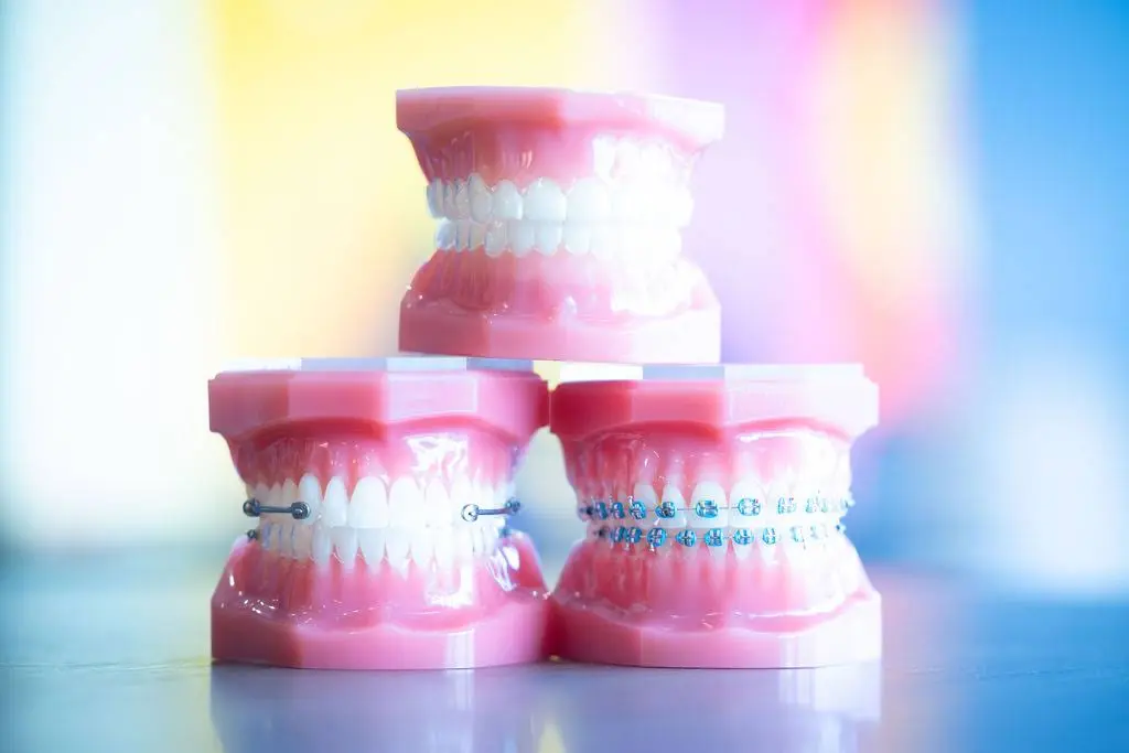 Petrous Orthodontics