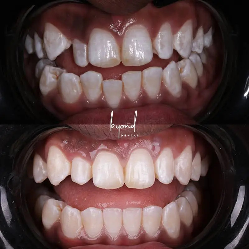 Byond Dental