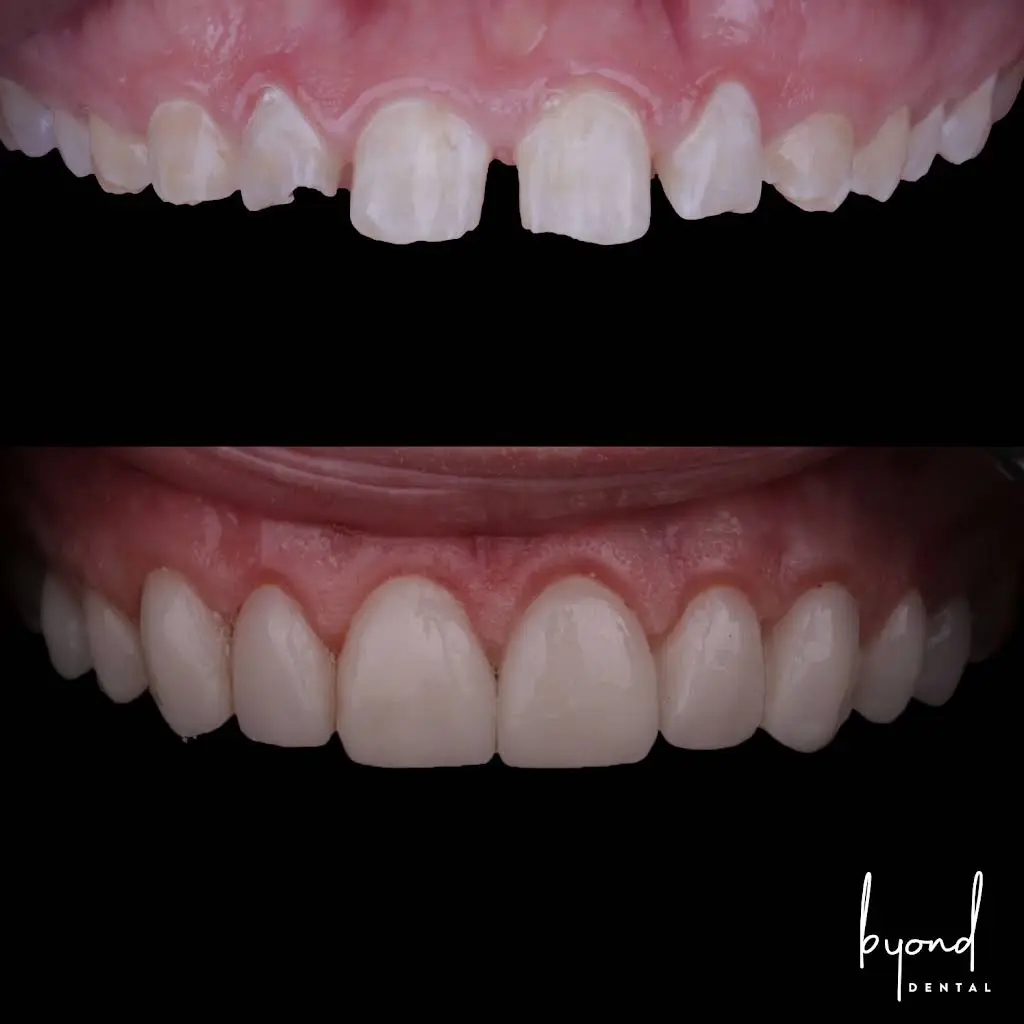 Byond Dental
