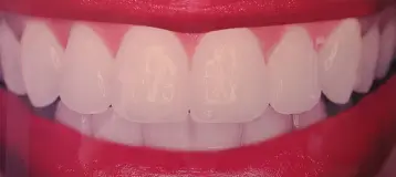 Laurich Dentistry Canton