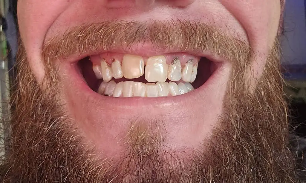Refresh Dental
