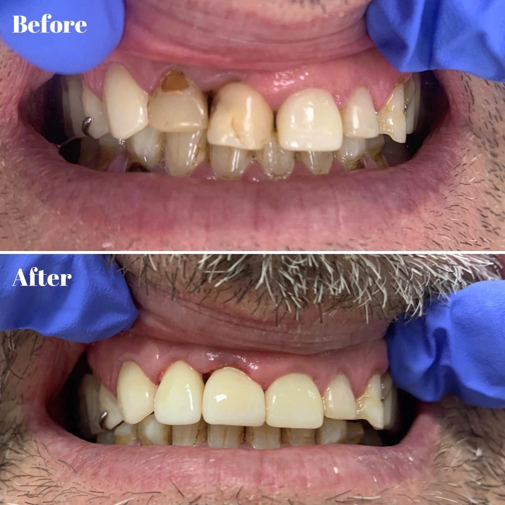 My Family Dental Care