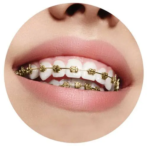 All About Orthodontics