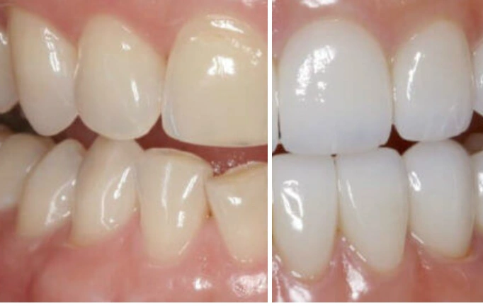 Intrinsic Family Dental