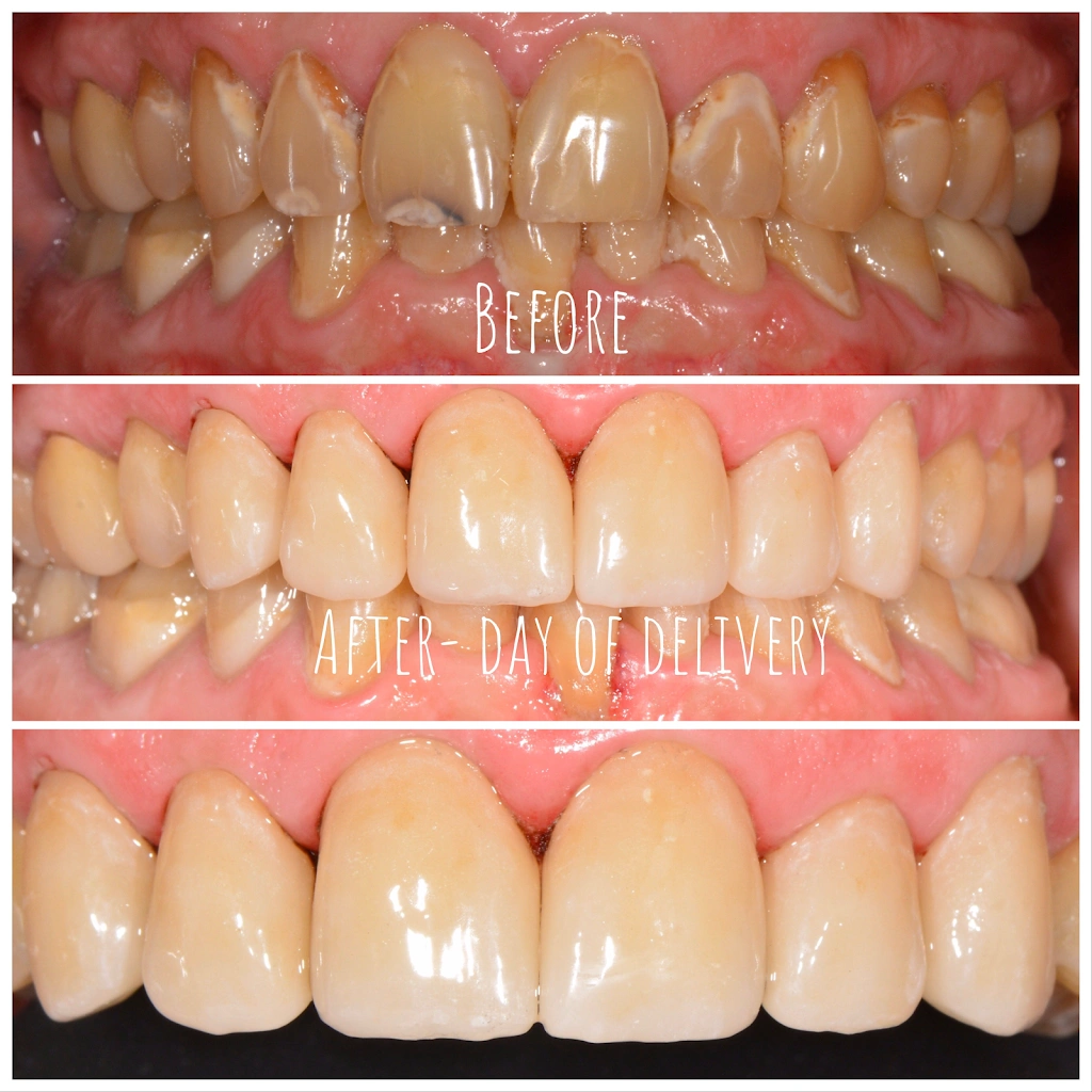 Smiles For Life- Dr. Nate Heffelfinger