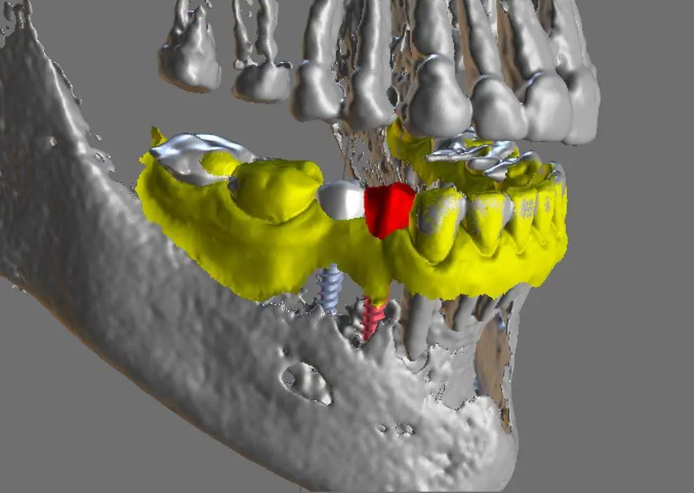 Smiles For Life- Dr. Nate Heffelfinger