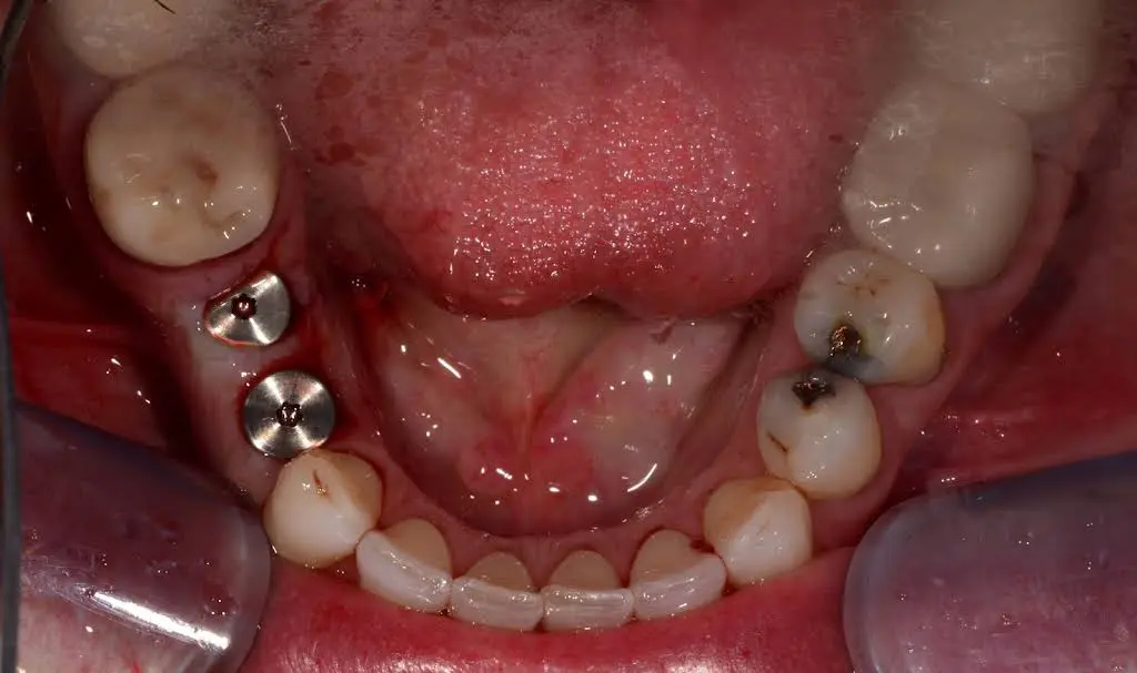 Smiles For Life- Dr. Nate Heffelfinger