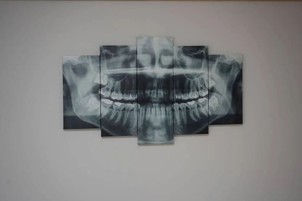 Dental Care Of Canton