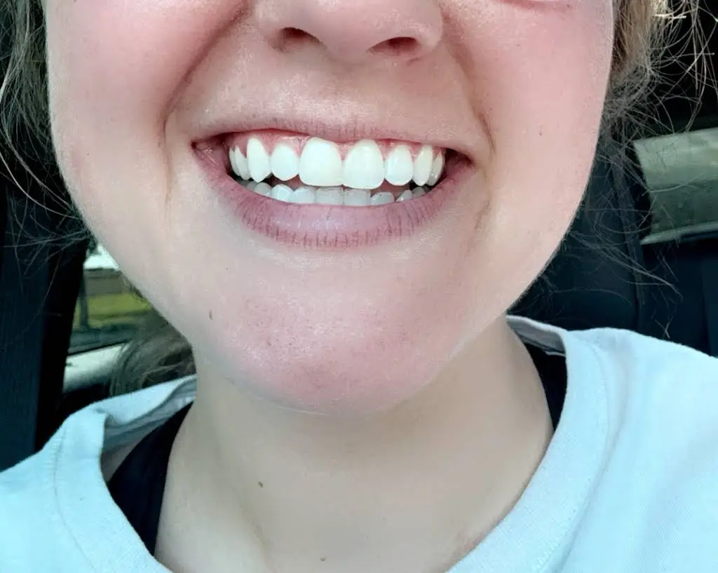 Dental Care Of Canton