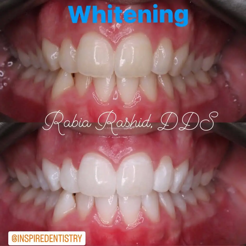 Inspire Dentistry