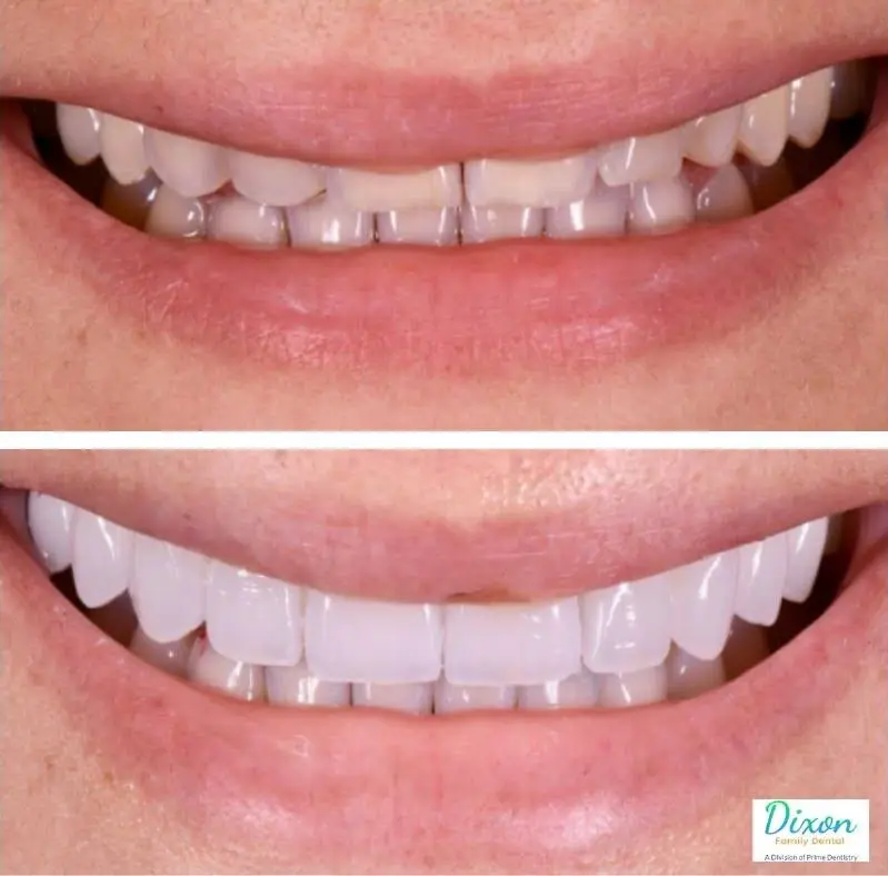 Dixon Family Dental