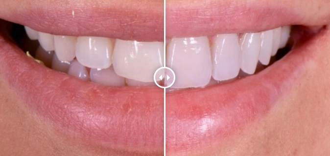 Dixon Family Dental