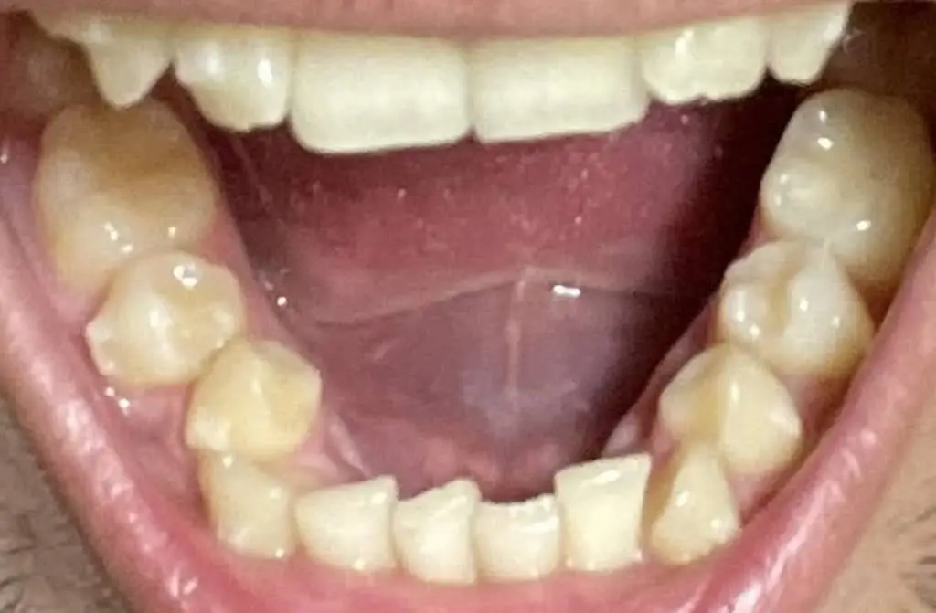 Redwood Dental St. Clair Shores