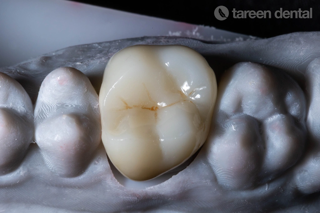 Tareen Dental