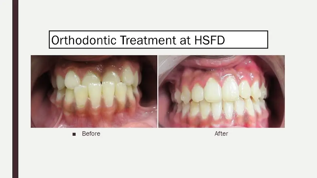 Happy Smile Family Dental and Fastbraces