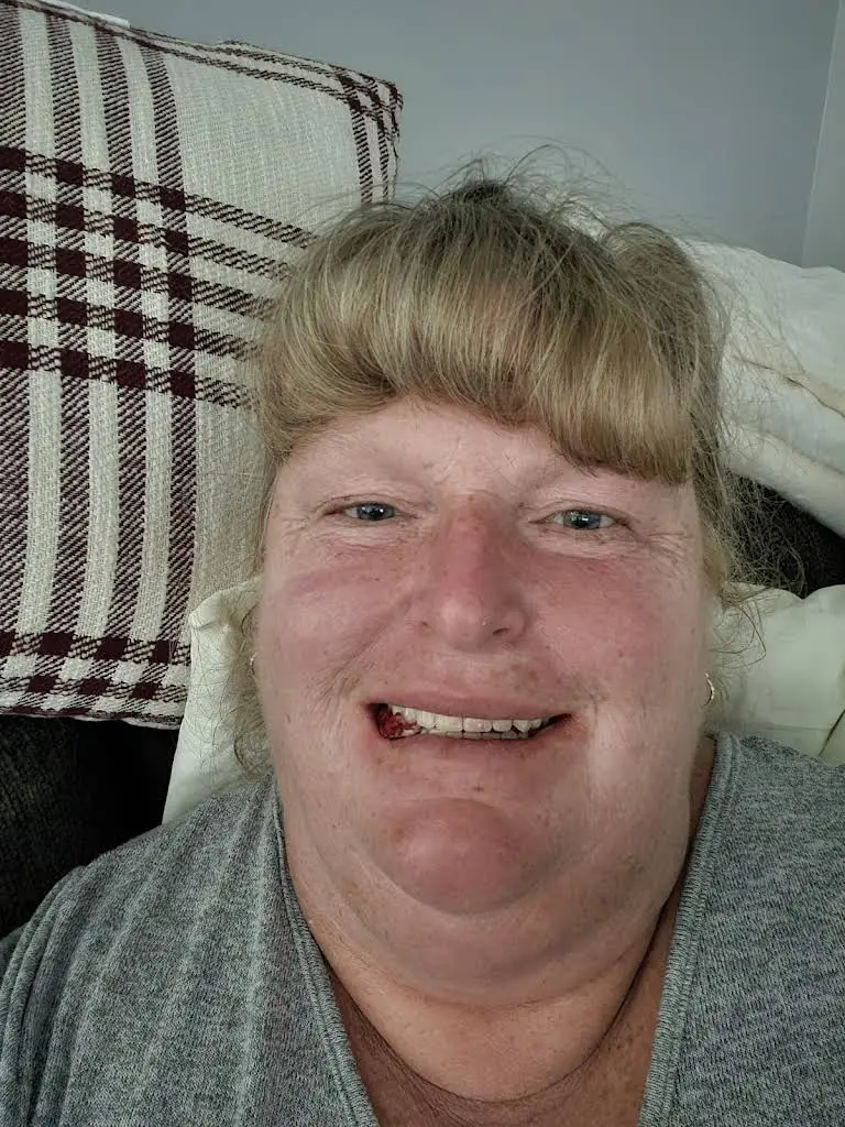 Affordable Dentures & Implants