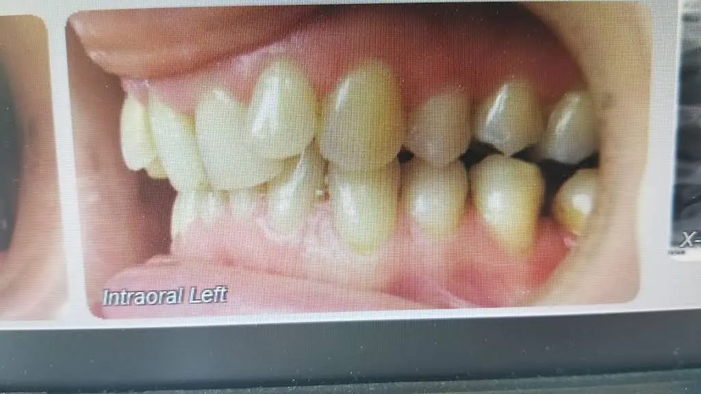 LakePointe Orthodontics