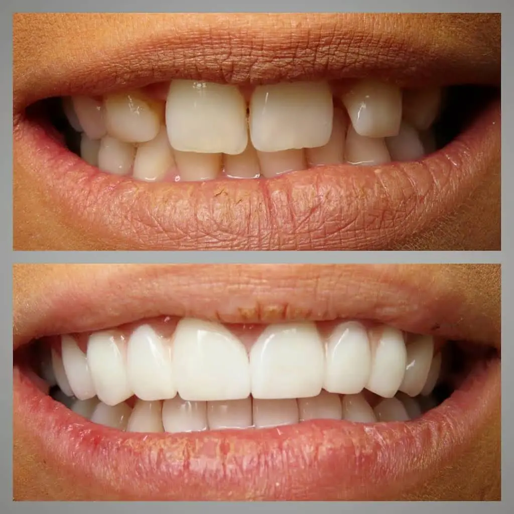My Family Dental Grosse Pointe