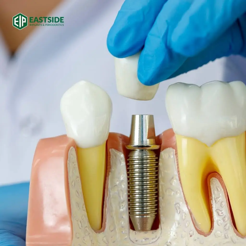 Eastside Implants & Periodontics