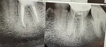 Forest City Endodontics