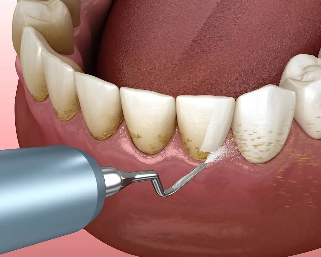 Front Street Dental House