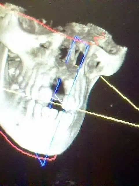 Whittaker Dental