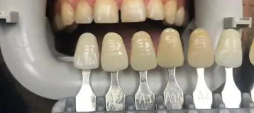 Smile Dental Hamtramck