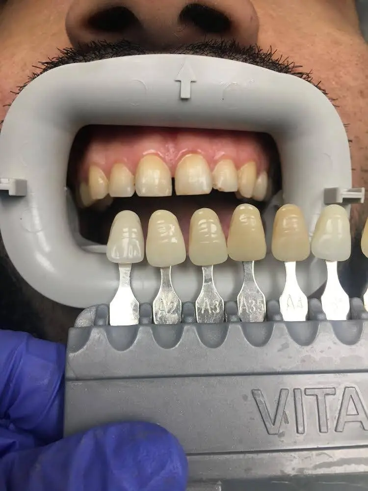 Smile Dental Hamtramck