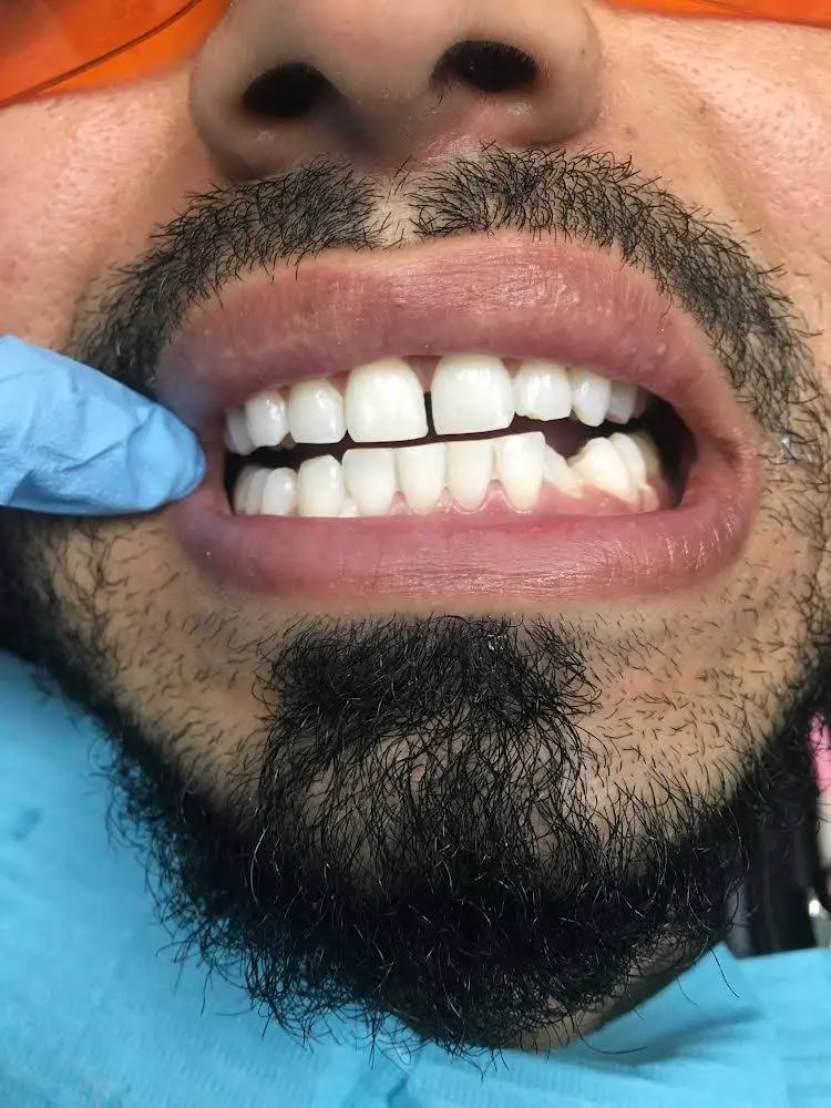 Smile Dental Hamtramck
