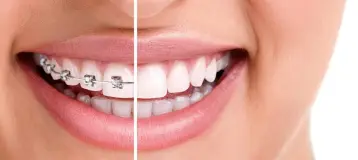 Baby & Rojas Certified Orthodontic Specialists