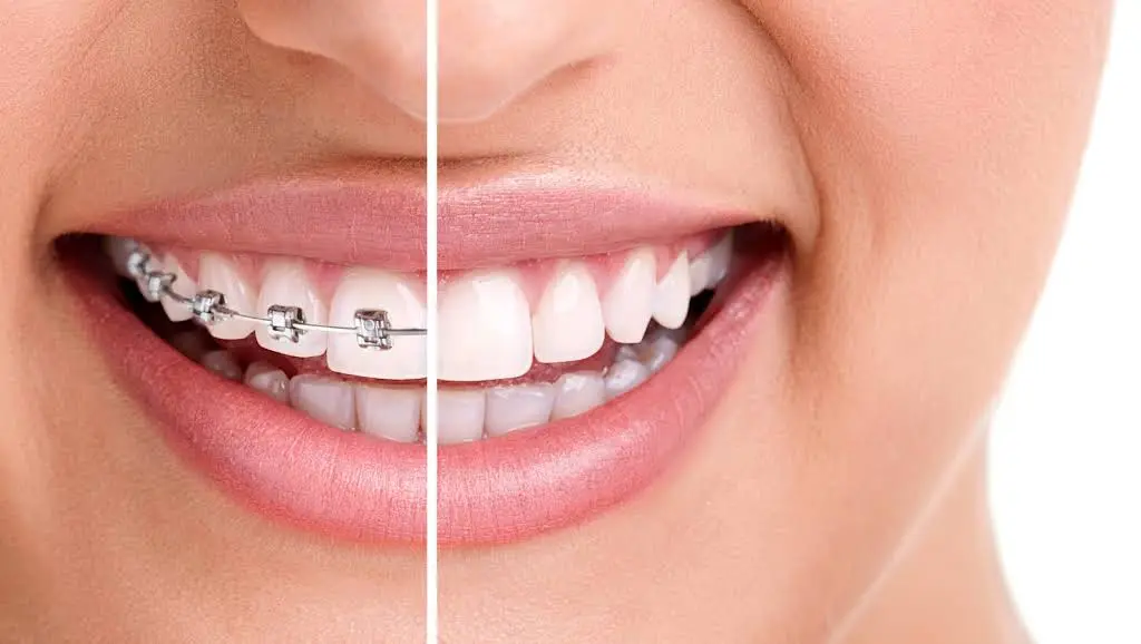 Baby & Rojas Certified Orthodontic Specialists