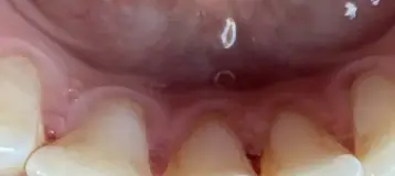 Alpha Dental Center