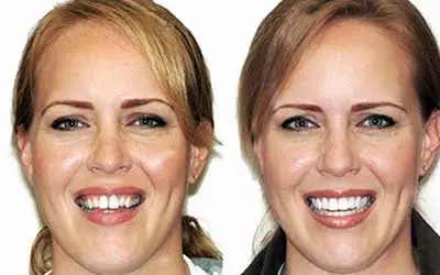 Painless Dentistry