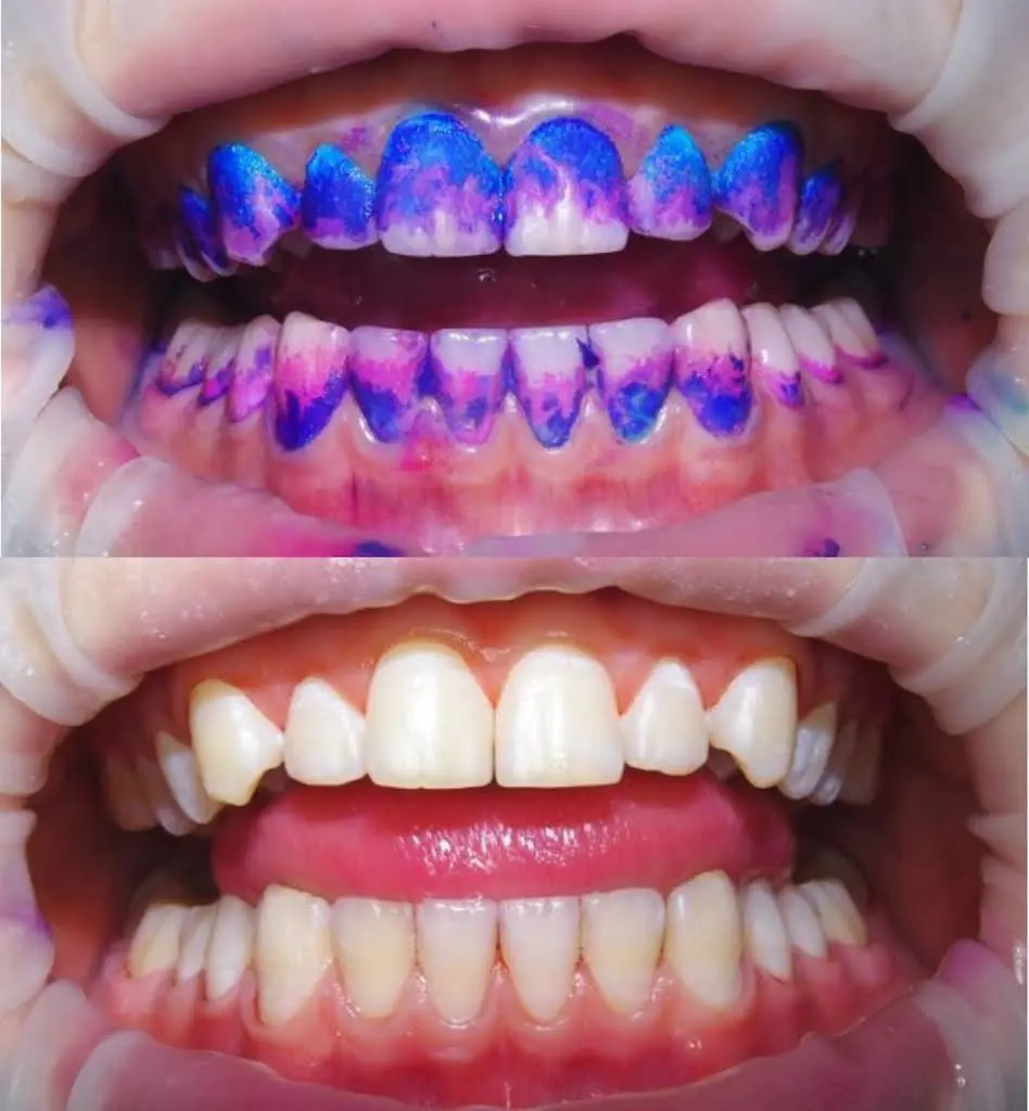 Norfolk Dental Hygiene