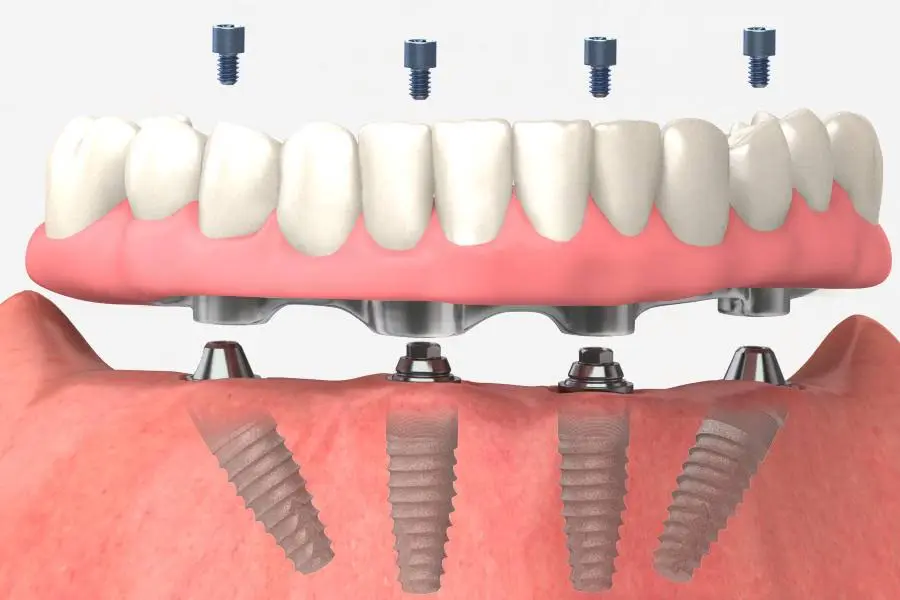 Ladd Dental Group of Peru