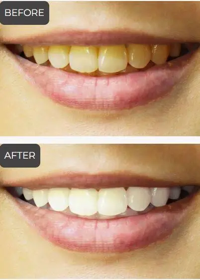 Elite Dental