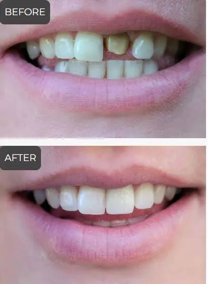 Elite Dental