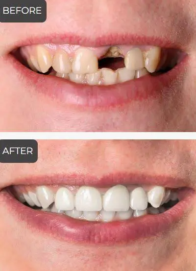 Elite Dental