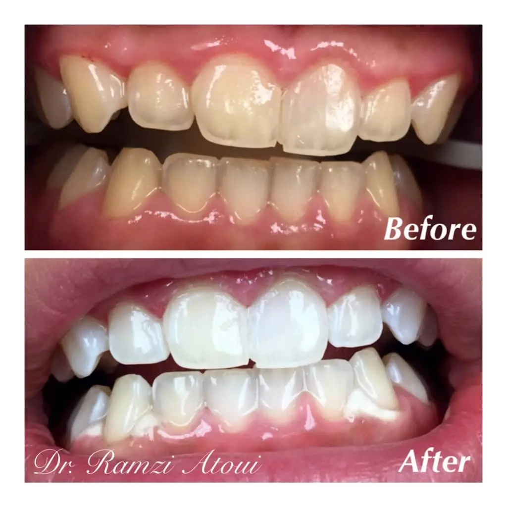 Lakewood Dental Group