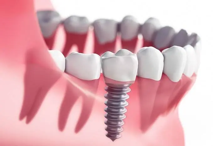Family Dental DR. JEFFREY BENSIMON
