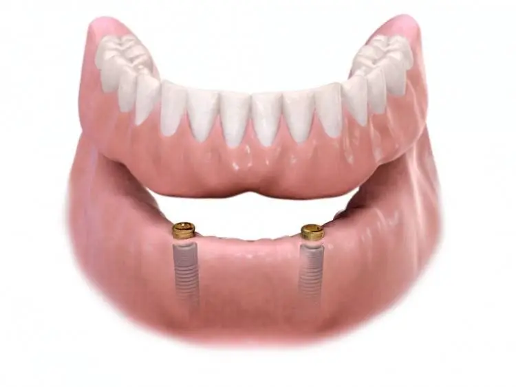 Brantford Dental Care