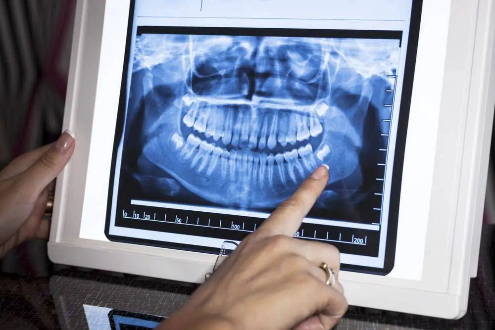 Campus Dentist Waterloo
