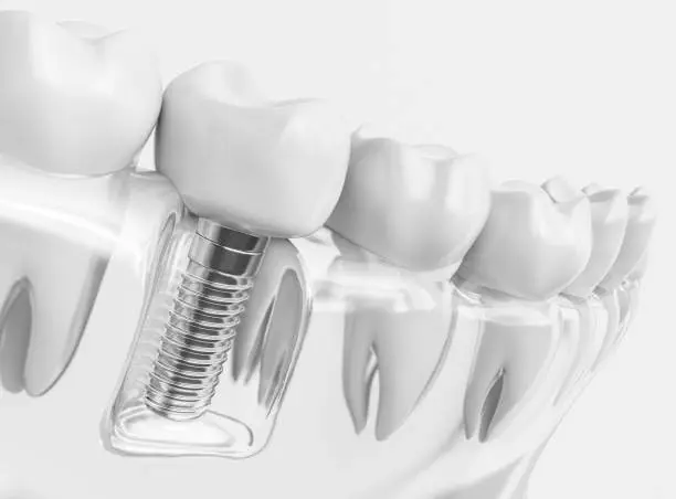 Parkside Drive Dental Waterloo
