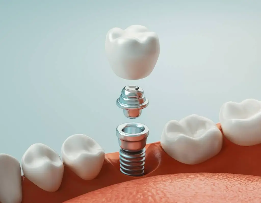 Forest Hill Family Dental